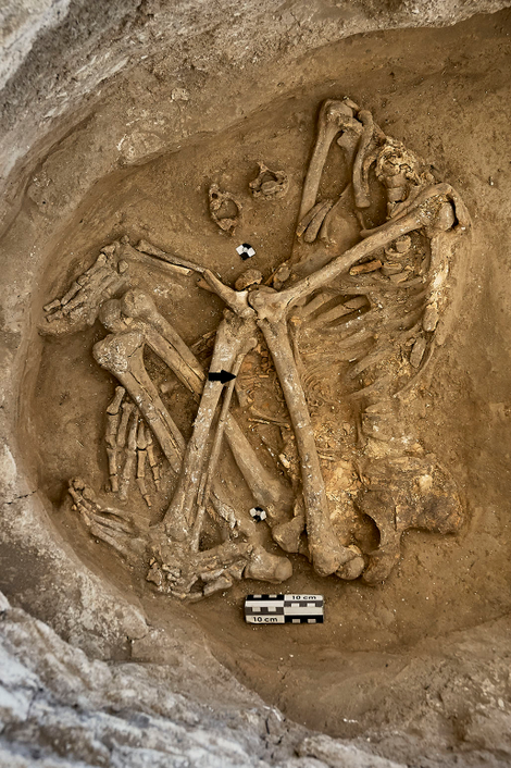 This old female headless was buried in the hatalhöyük with its unborn fruit (marked with a black arrow in the middle). The removal of the skull before burial was a common burial case in the region at that time.